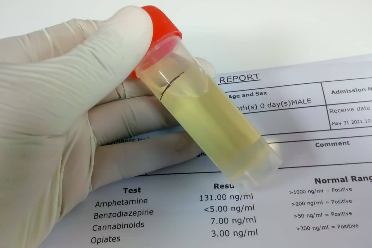 Drug Tests of Delta 8 and Delta 11