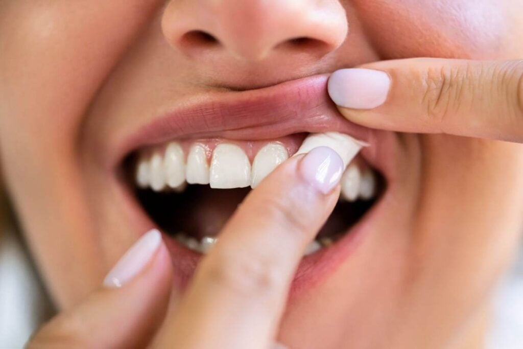 A lady is taking a nicotine pouch